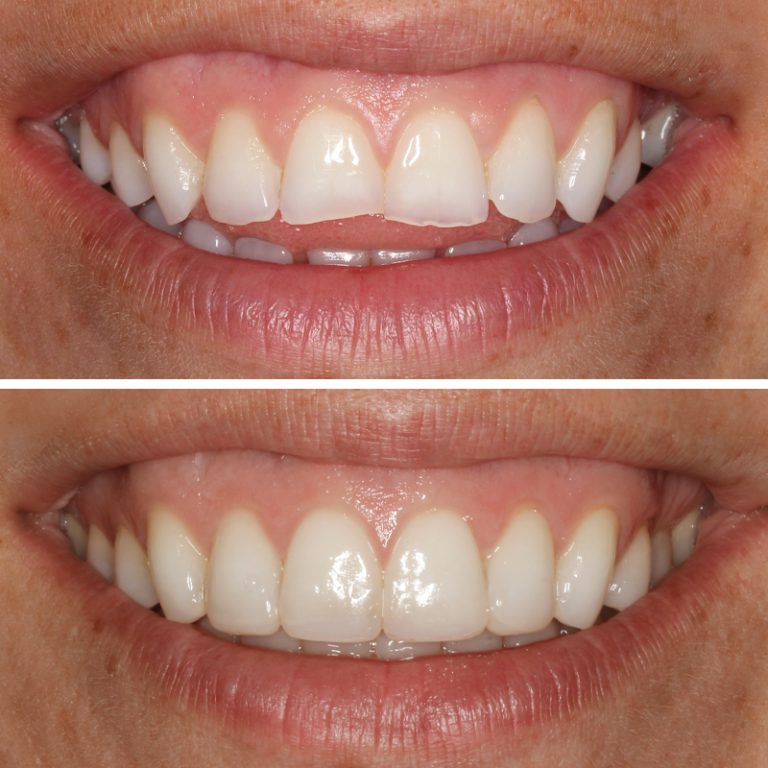 Caso Clínica Dental Romero Hermo