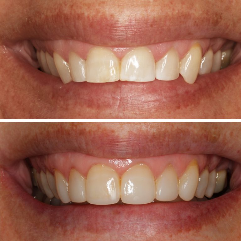 Caso Clínica Dental Romero Hermo
