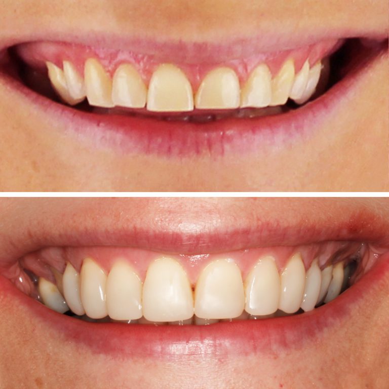 Caso Clínica Dental Romero Hermo