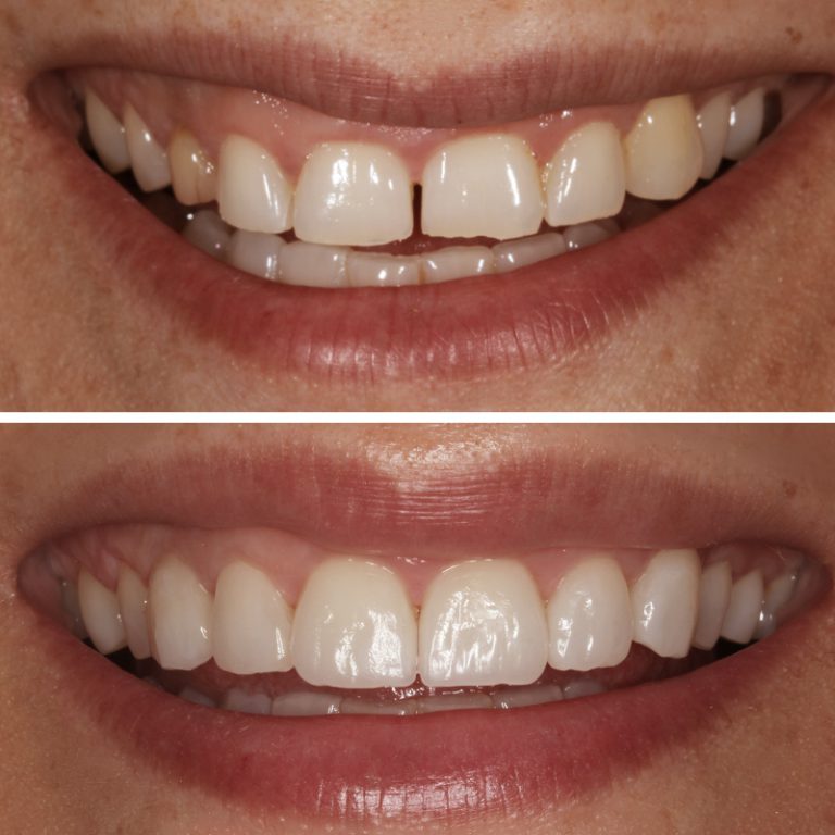 Caso Clínica Dental Romero Hermo