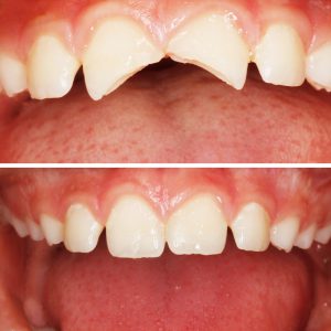Caso Clínica Dental Romero Hermo
