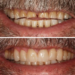 Caso Clínica Dental Romero Hermo