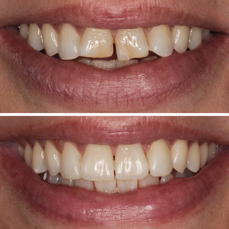 Caso Clínica Dental Romero Hermo