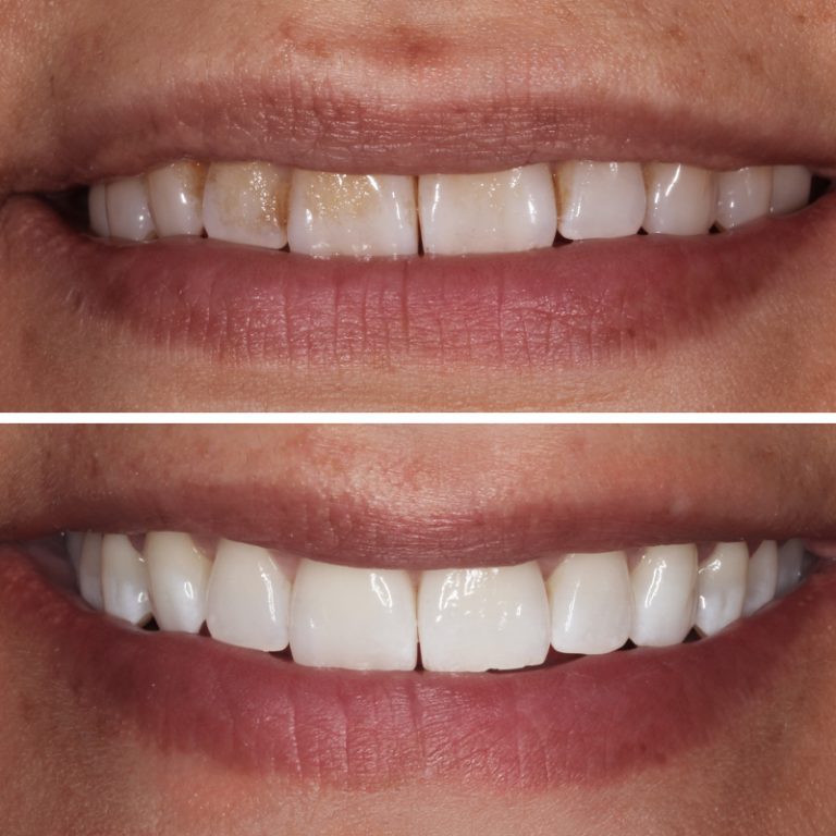 Caso Clínica Dental Romero Hermo