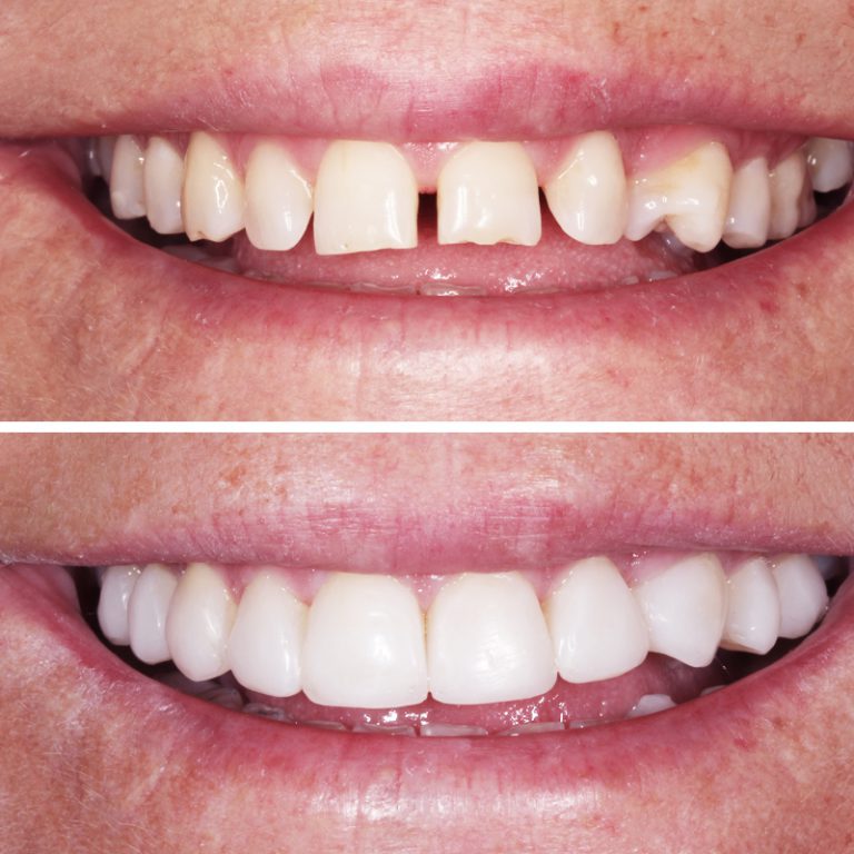 Caso Clínica Dental Romero Hermo