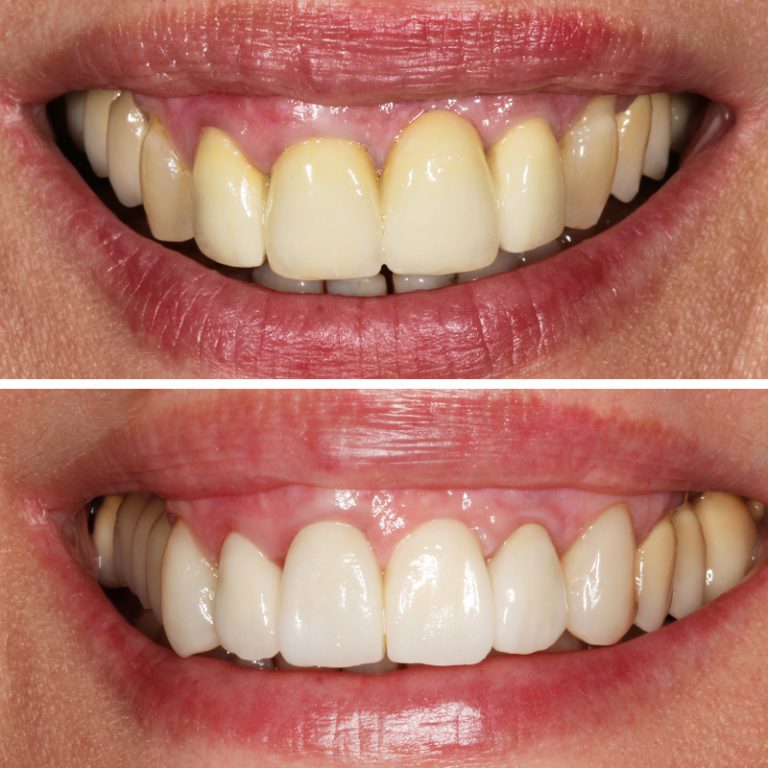 Caso Clínica Dental Romero Hermo