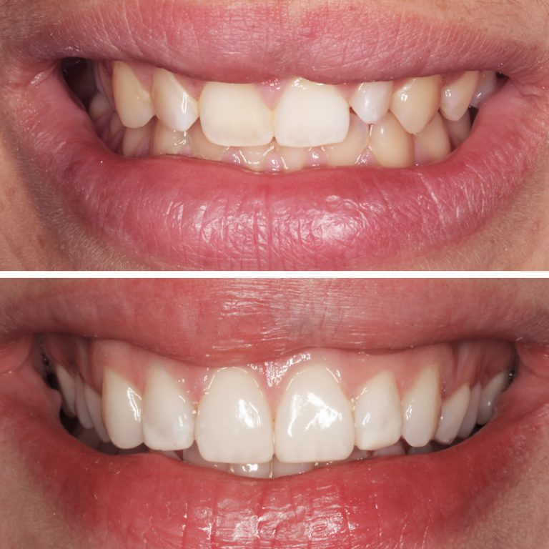 Caso Clínica Dental Romero Hermo