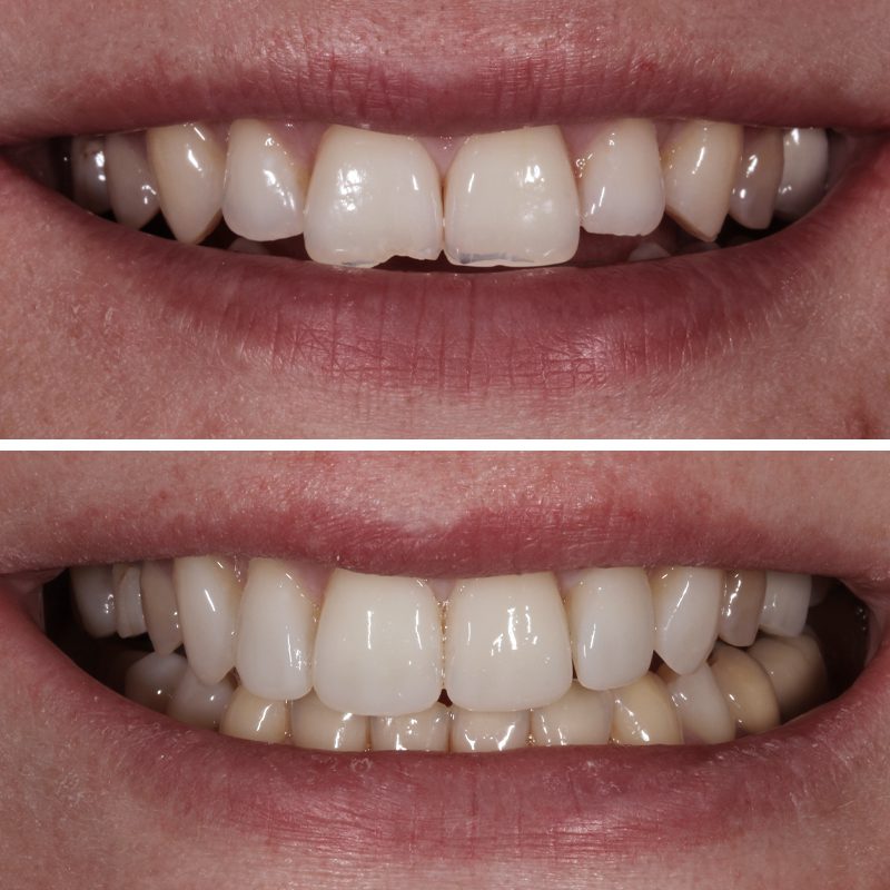 Caso Clínica Dental Romero Hermo