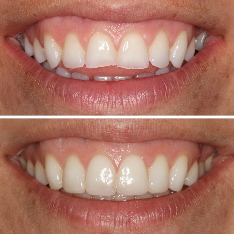Caso Clínica Dental Romero Hermo