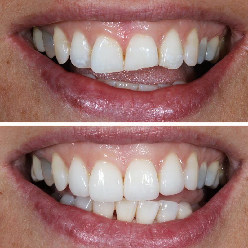 Caso Clínica Dental Romero Hermo