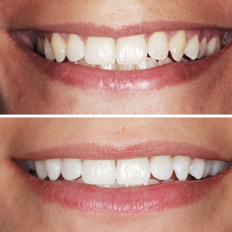 Caso Clínica Dental Romero Hermo