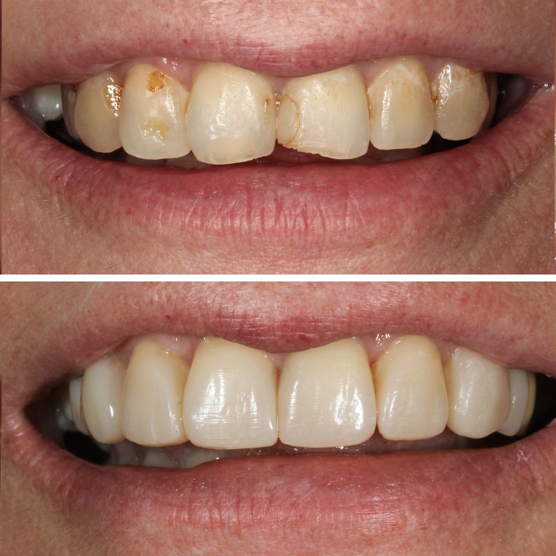 Caso Clínica Dental Romero Hermo